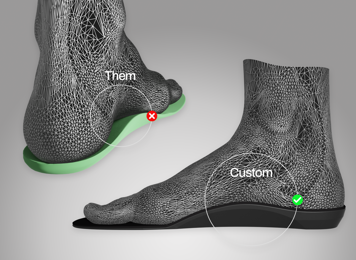 Why custom running insoles infographic
